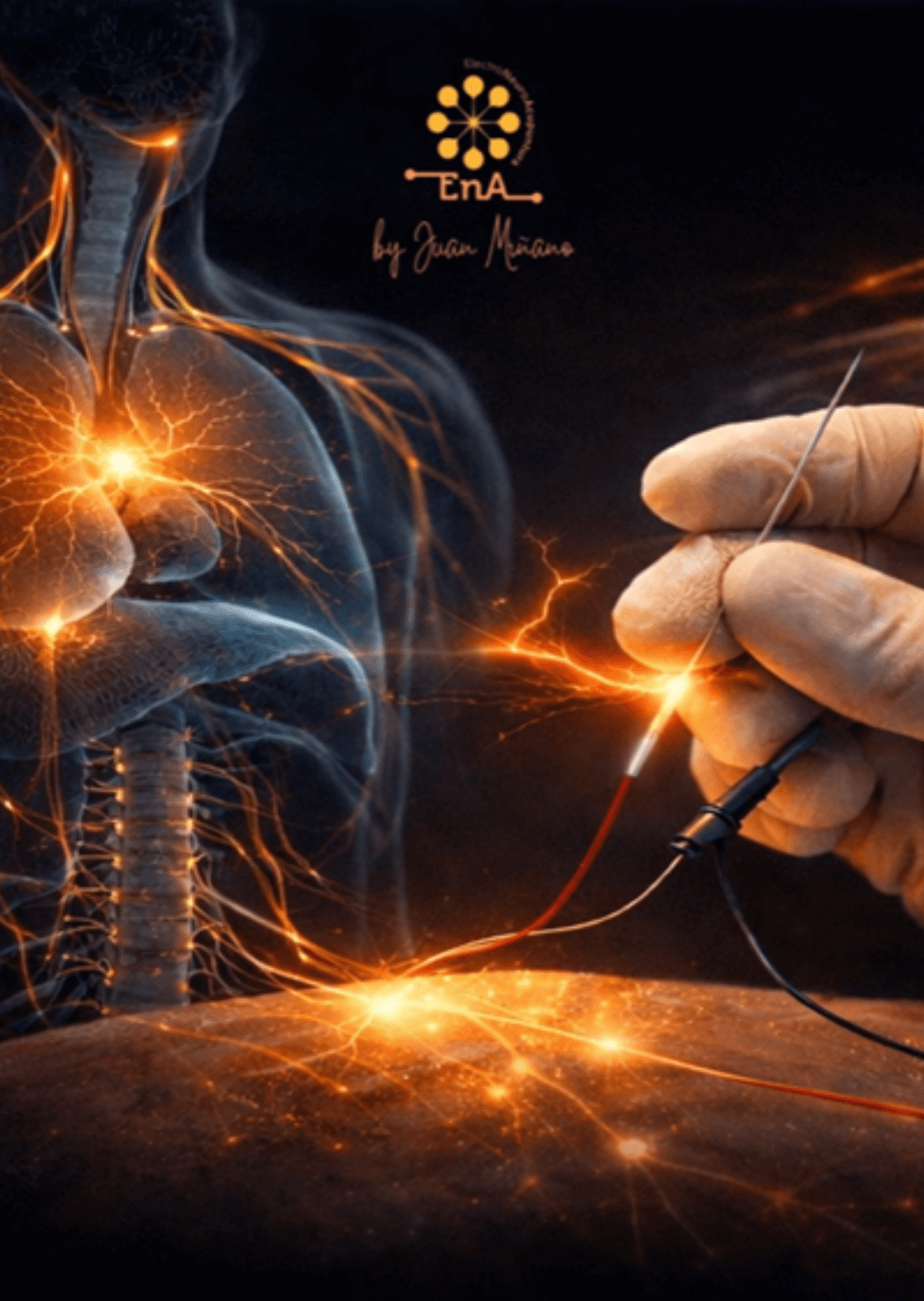 I ElectroNeuroAcupuntura y Neuroraquis